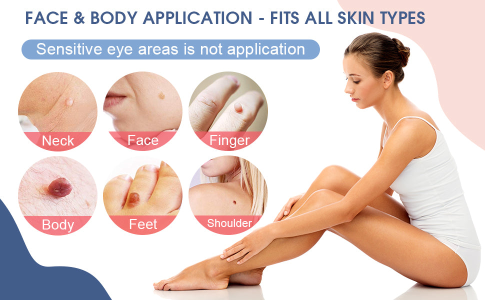 ULK-S02 Painless Mole Wart Remover Skin Tag Removal Kit