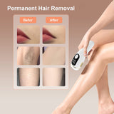 ULK-004 999999 Flashes IPL Epilator