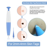 ULK-S02 Painless Mole Wart Remover Skin Tag Removal Kit