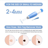 ULK-S02 Painless Mole Wart Remover Skin Tag Removal Kit