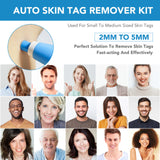 ULK-S03 2 In 1 Skin Tag Removers Kit