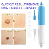 ULK-S08 Skin Tag Removal Kit Painless & Safe Removers